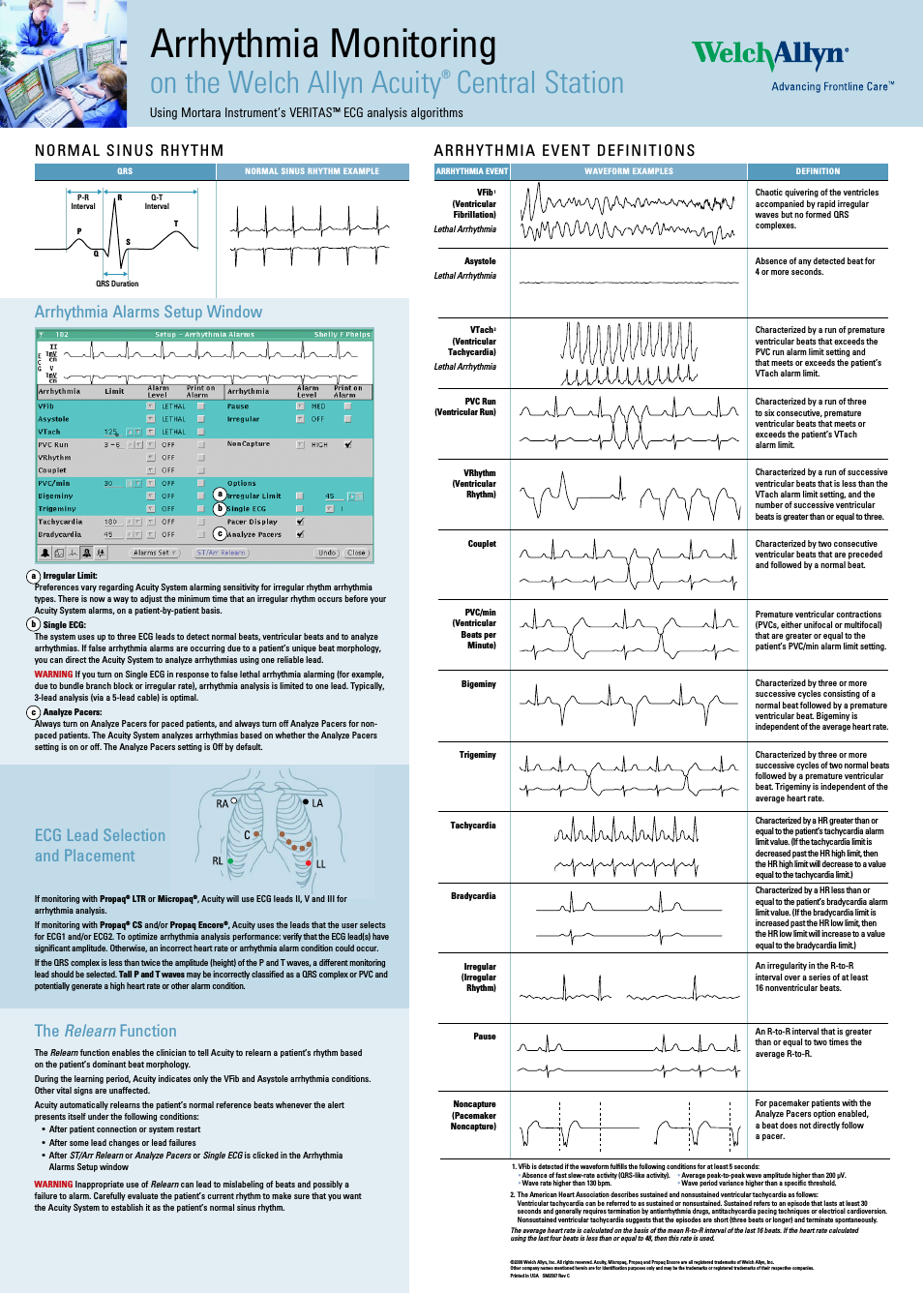 Arrhythmia Monitoring Chart - Quick Reference Guide