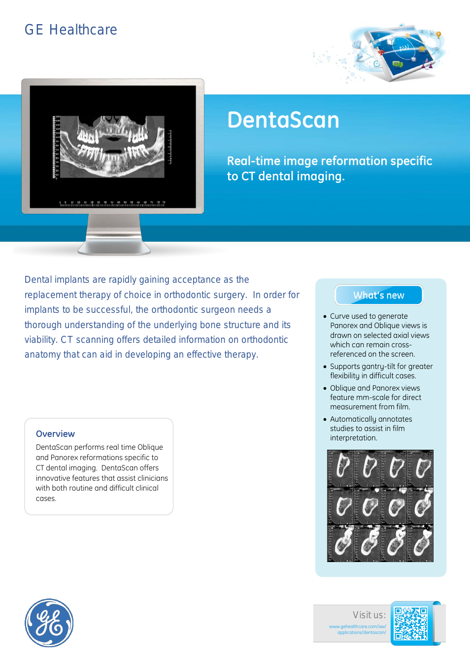 DentaScan