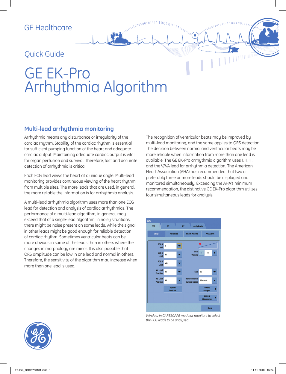 GE EK-Pro Arrhythmia Algorithm