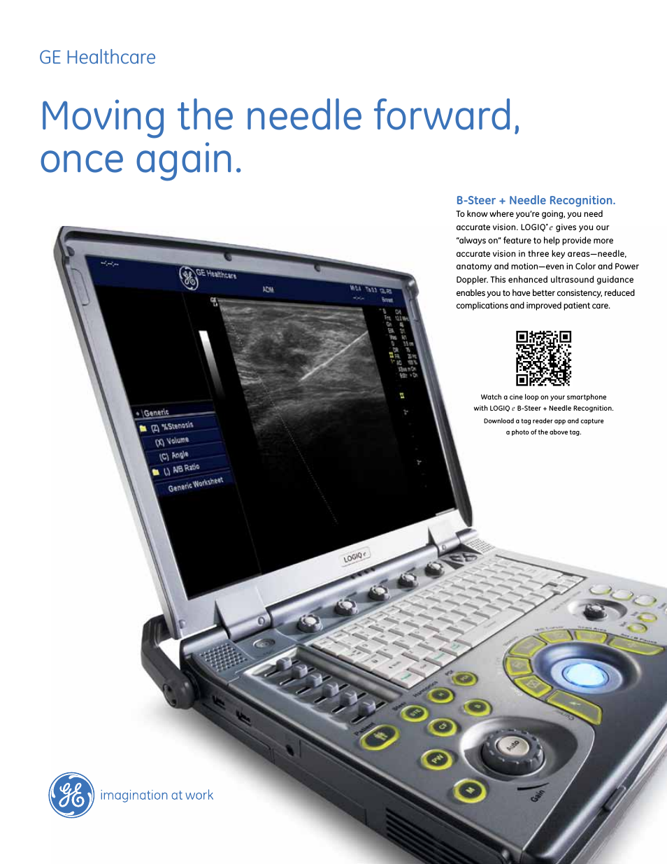 LOGIQ e B-Steer + Needle Recognition Accuracy redefined